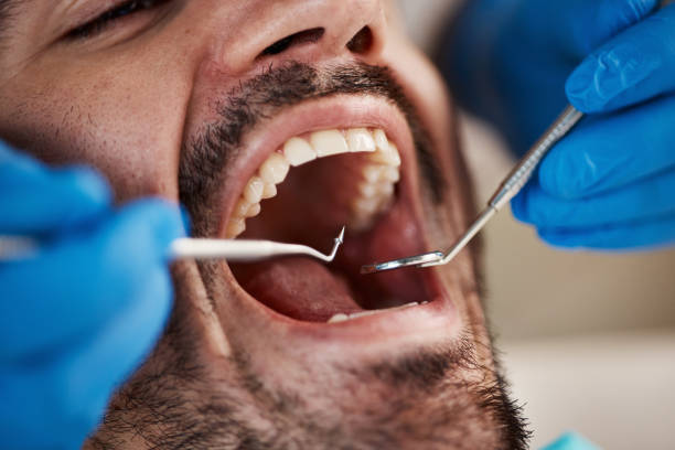 Best Emergency Dentist for Special Needs Patients in Cheval, FL