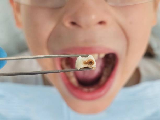 Best Weekend Emergency Dentist in Cheval, FL
