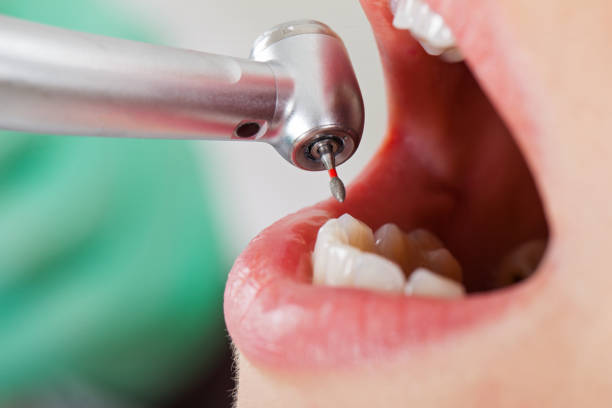 Best Weekend Emergency Dentist in Cheval, FL
